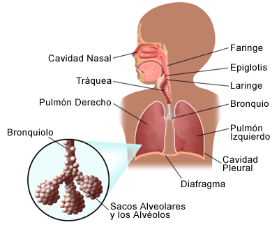 bronquiolitis